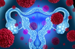 Gynecologic oncologists