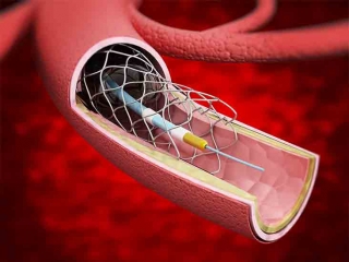 Invasive and interventional cardiologists
