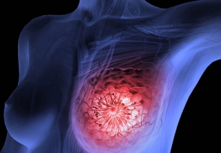 Oncologists-Mammologists