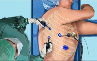 Pediatric thoracic surgeons