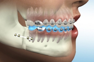 Maxillofacial surgery centers